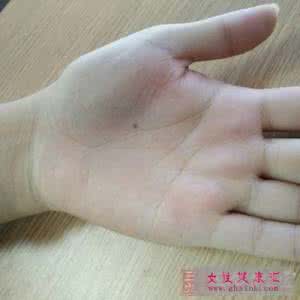 智慧线开叉 惊 手上这条线开叉竟暗示将婚变