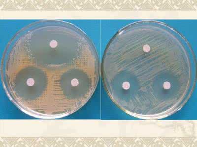 脓汁标本的分离培养 脓汁 病原生物学综合性实验一脓汁和粪便标本中病原菌的检测