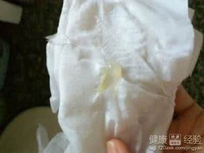 白带变色 怀孕白带会变色吗?