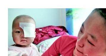 男婴患湿疹机会更大吗 出生3月男婴就患眼癌 或面临摘除眼球风险