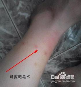 身上起红疙瘩越挠越痒 身上起红疙瘩越挠越痒 身上起疙瘩特别痒，越抓还越多！这是怎么了？！
