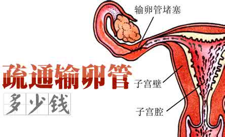 输卵管不通疏通手术 输卵管不通疏通手术 疏通输卵管手术介绍