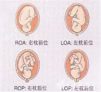 loa和roa胎位看男女 胎位roa和loa的区别
