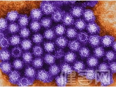 轮状病毒性腹泻治疗 诺如病毒 诺如病毒，腹泻爆发的常见“肇事者”