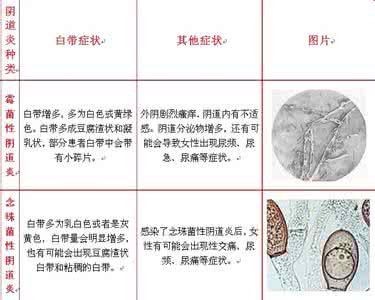 六类阴道炎不同瘙痒不同区分