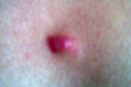 生完孩子腋下有硬块 生完孩子腋下有硬块 生完孩子腋下有硬块是什么原因