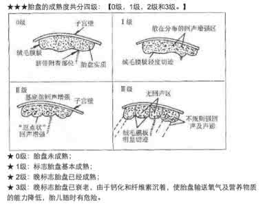 胎盘前壁是什么意思 胎盘分级是什么