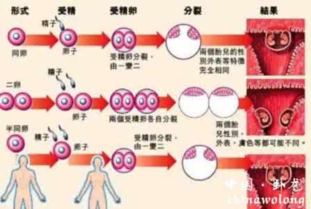 印度电视剧奇迹 医学奇迹 印度一“阴阳人”产下龙凤胎