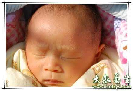 新生儿abo溶血性黄疸 abo溶血性黄疸 什么是新生儿溶血性黄疸