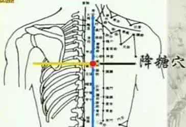 经络腧学第九版教科书 糖尿病的经络腧空外治法