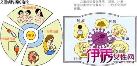 艾滋病传播途径图片 艾滋病传播途径 艾滋病传播途径图片