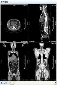 超声计算机图文报告 图文解读】X光、CT、MR、超声 一张图帮你了解医学影像