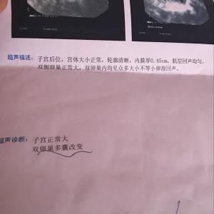 多囊卵巢怀孕几率大吗 多囊卵巢可以怀孕吗 多囊卵巢怀孕的几率