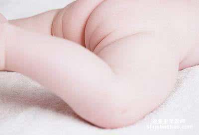 尿布疹护理 夏季宝宝患尿布疹怎样护理
