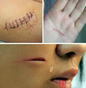 身上这处疼痛竟是癌症 皮肤出现它竟是癌症晚期(2)