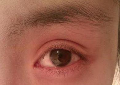 杏仁眼是什么样的 杏仁眼是什么样的 有关于杏仁眼的探讨