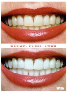 一白遮百丑一胖毁所有 一白遮百丑一胖毁所有 牙白遮百丑牙黄毁所有!想唇红齿白这些食物能帮忙!