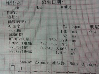 窦性心律不齐的症状 窦性心律不齐怎么缓解 窦性心律不齐有哪些症状