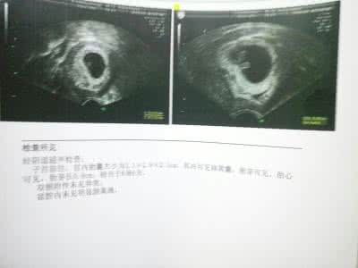 b超女宝 生下来是男宝 b超女宝 生下来是男宝 怀孕后对久能知道怀男宝女宝?医生说这样做就行!