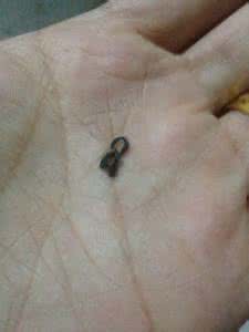 痣疮是什么症状 痣疮 痣疮是什么？