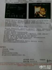 胎儿几个月胎位定型 胎儿几个月定胎位呢?