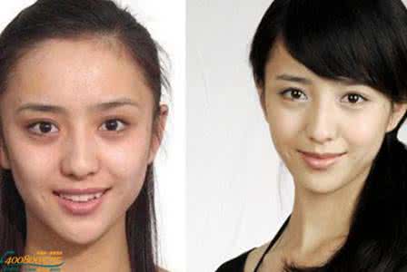 佟丽娅丑照 佟丽娅整容 佟丽娅整容前后对比 整容前的丑照让人不堪回首