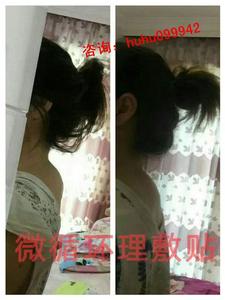 脖子后面的富贵包图片 富贵包的危害 富贵包危害 脖子后面突然长出这物那你摊上大事