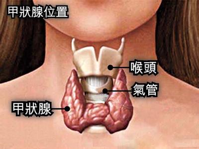 甲状腺炎吃什么药 甲状腺炎预防 甲状腺炎吃什么药 怎么预防甲状腺炎