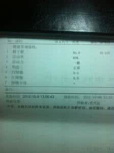精子存活时间是多久 详细阐述精子的存活时间是多长
