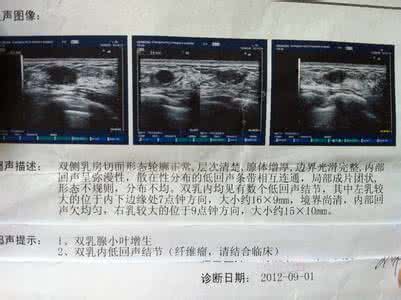 纤维瘤手术后注意事项 纤维瘤严重吗 纤维瘤手术后的注意事项