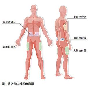 胰岛素笔使用方法视频 糖尿病人如何使用胰岛素