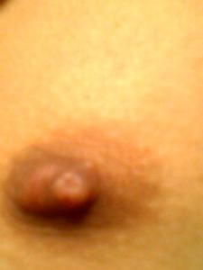 乳头刺痛怎么回事 乳房刺痛乳头痒怎么回事