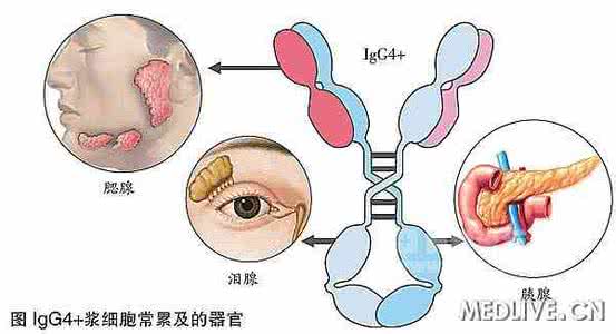 肝经风邪引眼睛流泪 泪少眼干竟是肝不好 论五种体液与内脏的关系