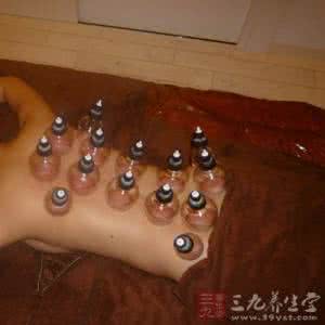 内痔疮的最佳治疗方法 痔疮的拔罐疗法
