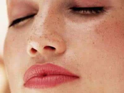 快速治疗面部过敏 秋季过敏怎么办 4个食疗方防治过敏