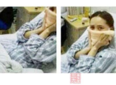 修复失败眼部整形整容 女孩整容太美遭暴打 打人者曾整形失败