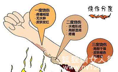 烧烫伤急救 烧伤烫伤自我急救方法