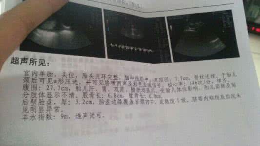 胎盘成熟度与什么有关 胎盘的成熟度