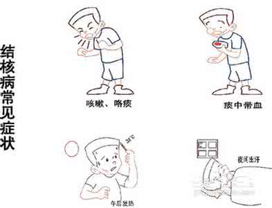 肺结核的临床表现 肺结核的症状 肺结核有哪些临床表现