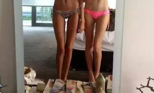 女人大腿根部缝隙大 女人大腿根部缝隙怎么改善