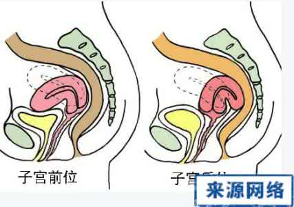 子宫后位怎样快速怀孕 子宫后位影响受孕吗
