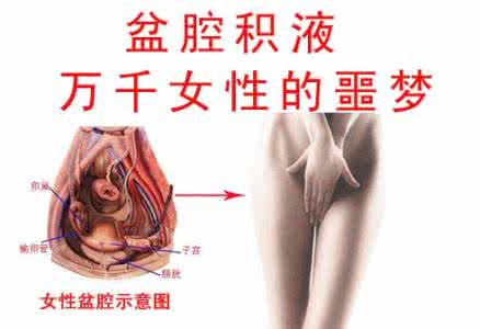 盆腔积液吃什么药好 盆腔积液吃什么药 治好你的盆腔积液