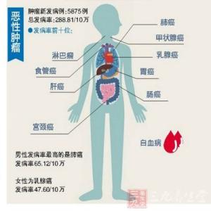 二手烟 肺癌 14年度健康报告 二手烟成厦门女性肺癌主因