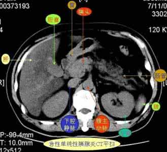 图集吧 图集 | 各种腹部CT，清楚讲解病变