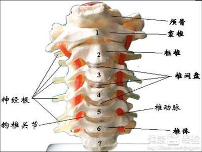 颈椎骨质增生的小偏方 颈椎骨质增生偏方 颈椎骨质增生怎么治疗