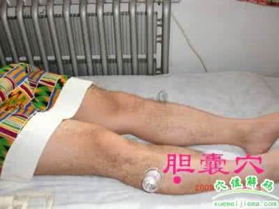 胆囊炎的症状及治疗 认识胆囊穴(胆囊炎的治疗分享)