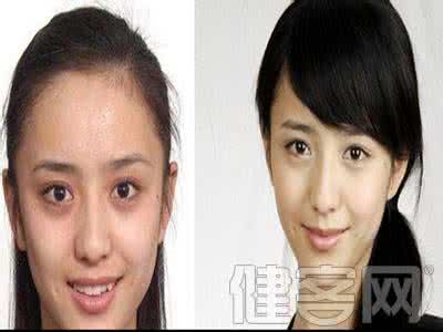 佟丽娅整容前后照片 佟丽娅整容前后 佟丽娅整容前后照片 为你揭秘整容前的样子