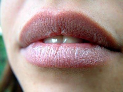 中国疾病预防控制中心 性疾病的前兆 疾病预防 嘴唇变色是这些疾病的前兆