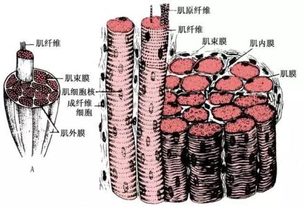 横纹肌溶解综合征 横纹肌溶解综合征 横纹肌溶解是什么导致的