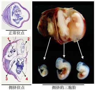 胚胎生化是什么意思 胚胎生化是什么意思的呢？